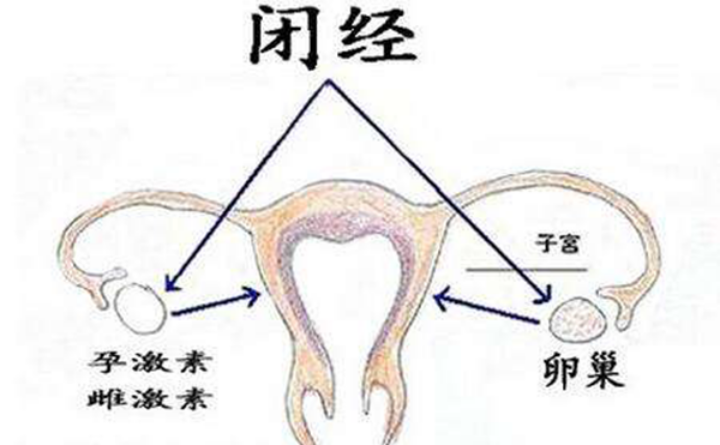 排卵障碍会影响女性月经