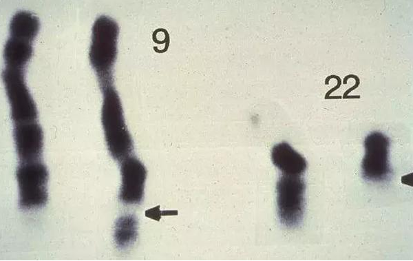 22号染色体
