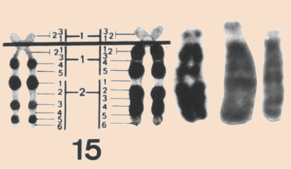 15号染色体