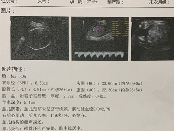 做核磁共振不会引起宫缩