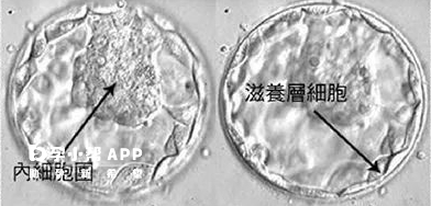 PGD/PGS技术就是在胚胎囊胚时就进行活检