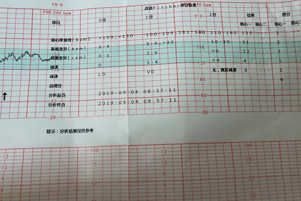 胎心监护检查单