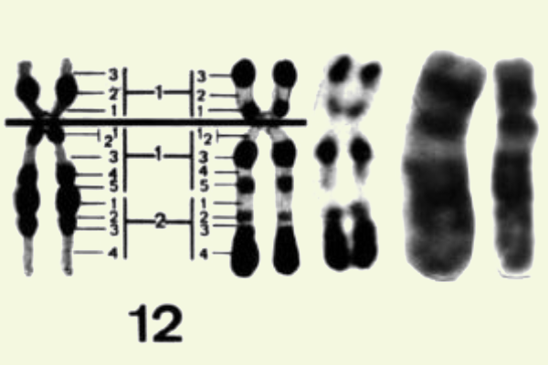 12号染色体