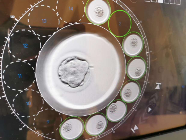 长春做试管不能100%成功