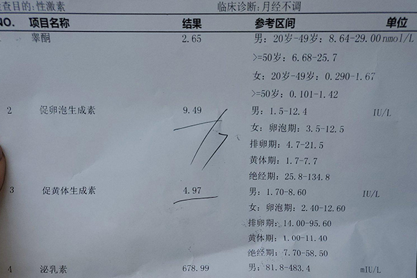 促卵泡生成激素检查单