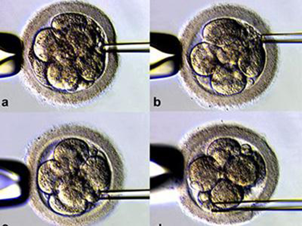 试管成功率与胚胎质量有关系