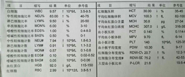 地贫的血常规特点