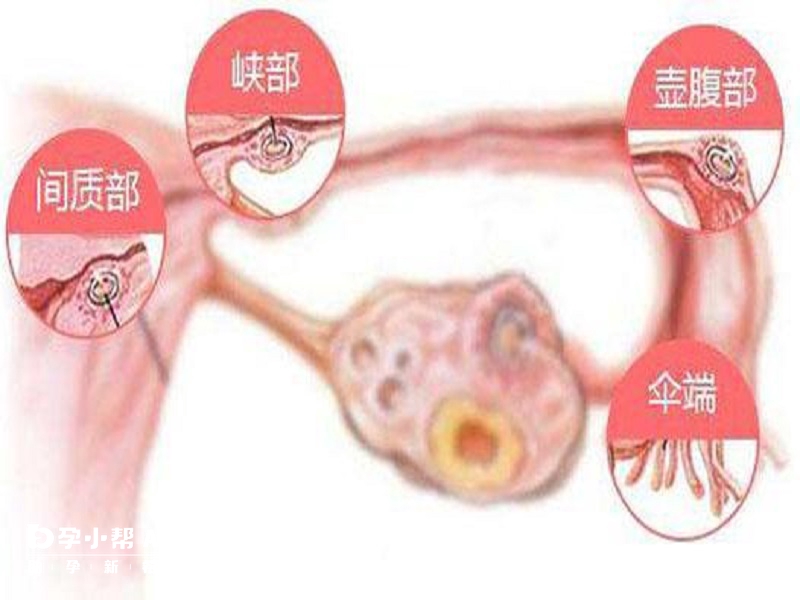 人授不适合高龄人群