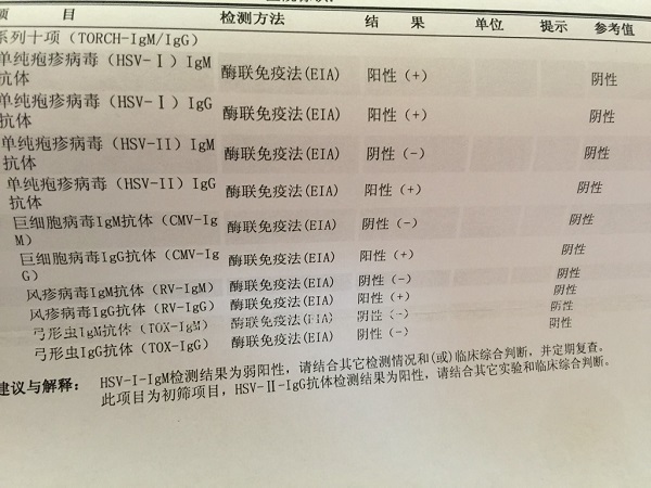 孕前需要做torch检查