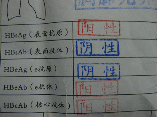 乙肝五项245阳性不是终身免疫