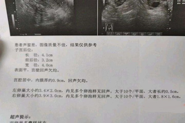 卵泡不破可以用针灸促进卵泡破裂